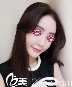 醫(yī)生給我做隆鼻第2天效果 醫(yī)生給我做隆鼻第2天效果