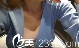 術(shù)前胸部平坦 術(shù)前胸部平坦