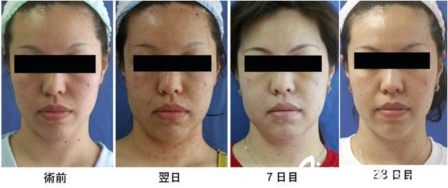 金線美容術(shù)2 金線美容術(shù)2