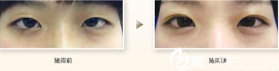 日本 TIARA 整形外科醫(yī)院