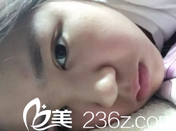 等待恢復(fù)的時(shí)間讓我好抑郁啊