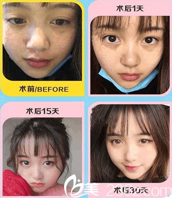 常州美貝爾怎么樣？看我做完<span style=