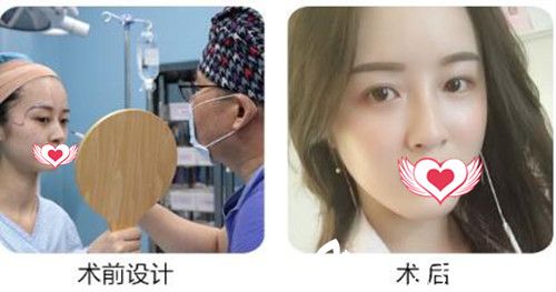 衡陽(yáng)美萊自體脂肪填充<span style= 衡陽(yáng)美萊自體脂肪填充<span style=