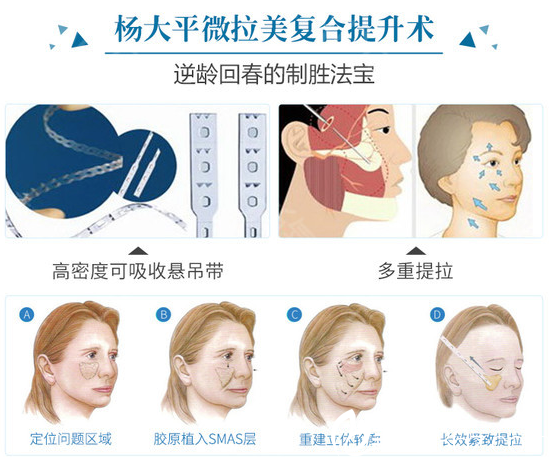 北京聯(lián)合麗格楊大平微拉美復(fù)合提升術(shù)示意圖