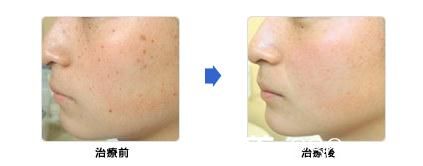 城野親德祛斑美肌 城野親德祛斑美肌