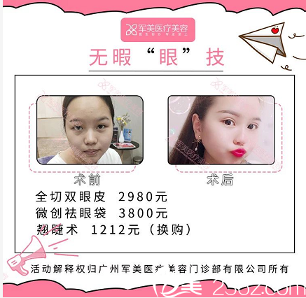 廣州軍美冀晨陽(yáng)雙眼皮案例價(jià)格表 廣州軍美冀晨陽(yáng)雙眼皮案例價(jià)格表