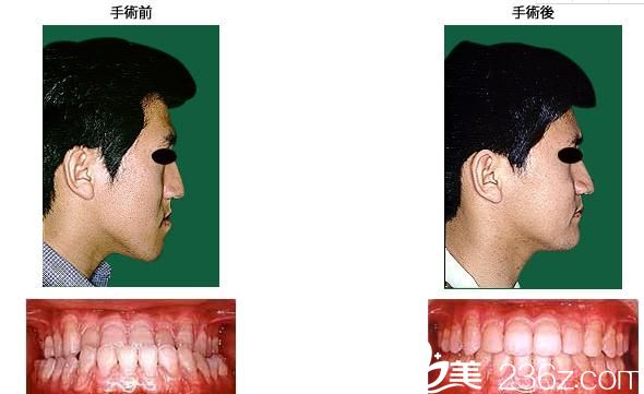 鶴木<!--<i data=20240703-sp></i>-->歯科醫(yī)院鄂變形治療