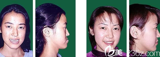 鶴木<!--<i data=20240703-sp></i>-->歯科醫(yī)院鄂變形治療