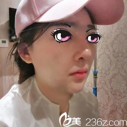 寧波尚麗鼻綜合7天圖