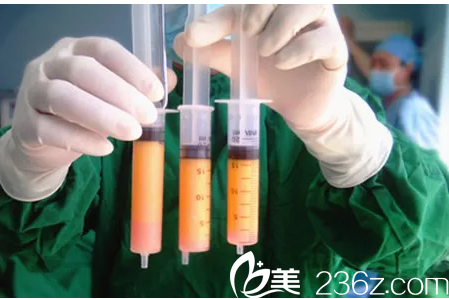 廣州壹加壹脂肪填充