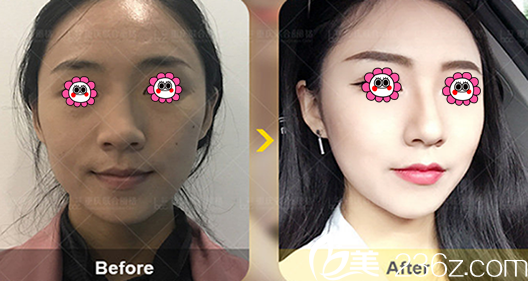 重慶隆鼻哪家好技術(shù)高？來(lái)看聯(lián)合麗格黨寧<span style=