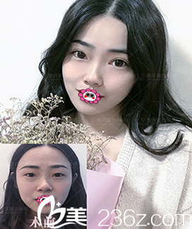 重慶聯(lián)合麗格整形醫(yī)院曹陽(yáng)<span style=