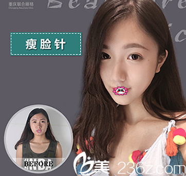 在重慶聯(lián)合麗格做陳曉雪<span style=