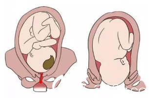 生孩子時候私密的樣子