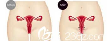 填充完成示意圖