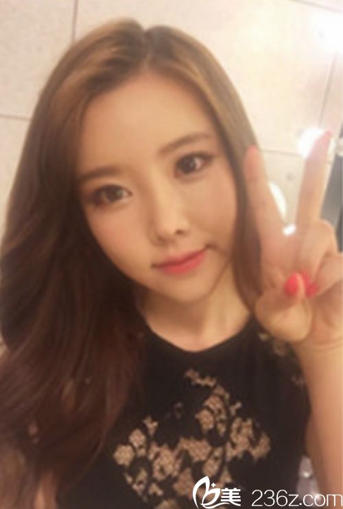 韓國新帝瑞娜面部輪廓+鼻修復手術術后第120天 韓國新帝瑞娜面部輪廓+鼻修復手術術后第120天