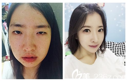 20181207_1544170863210142.jpg 對比 無水印.jpg