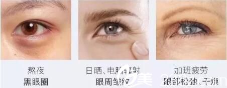 眼部膠原蛋白流出現(xiàn)的眼部問題