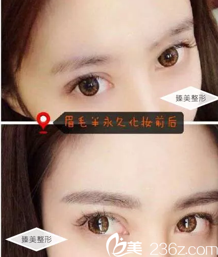 哈爾濱臻美半紋眉真人案例