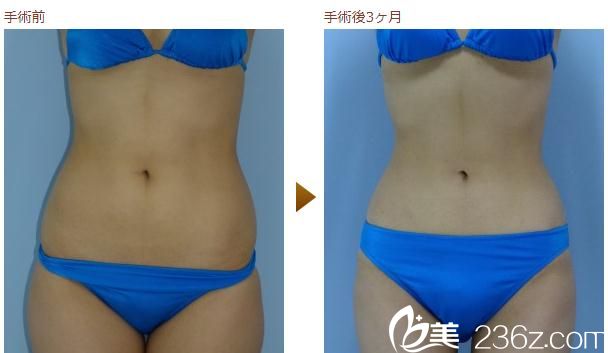 對比圖片 對比圖片