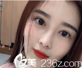 這是的第1211個(gè)雙眼皮修復(fù)案例，她曾經(jīng)做過(guò)三次眼部手術(shù)