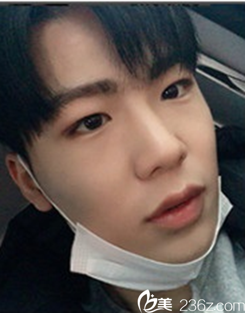 萬般無奈下到韓國灰姑娘膽戰(zhàn)心驚的做了鼻部+眼睛矯正，結(jié)果讓其他人傷心了