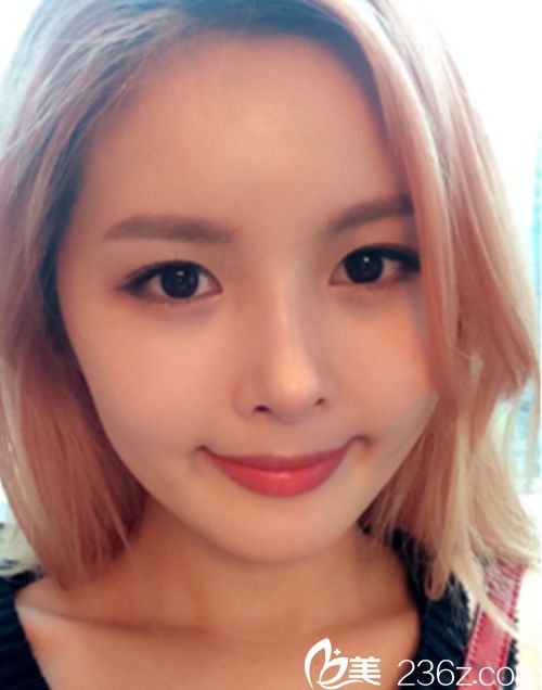 案列分享：年齡增長意識到了危機 韓國麥恩醫(yī)院眼部埋線+鼻部+脂肪填充 解除了警報