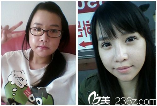 20181213_1544690936300484.jpg 對比無水印.jpg