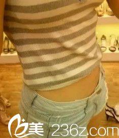 產(chǎn)后腰腹贅肉多怎么辦?來衡水天宏做完水動力吸脂術(shù)后我也擁有小蠻腰