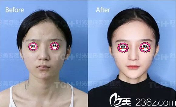 時光整形醫(yī)院馮輝利<span style=