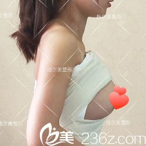 剛做完假體隆胸被紗布包裹著 剛做完假體隆胸被紗布包裹著