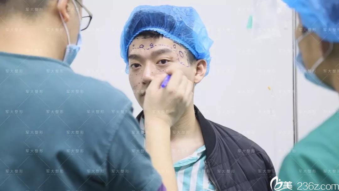 術(shù)前劃線設(shè)計確定脂肪填充位置 術(shù)前劃線設(shè)計確定脂肪填充位置