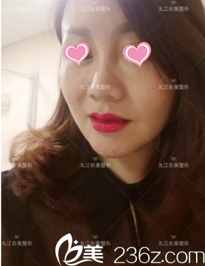 治療15天后效果