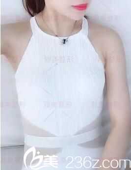 做娜綺麗假體隆胸術(shù)前照 做娜綺麗假體隆胸術(shù)前照