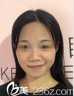 在南寧韓成做鼻綜合手術(shù)前 在南寧韓成做鼻綜合手術(shù)前