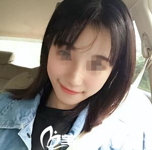 在南寧韓成做鼻綜合手術(shù)后10天 在南寧韓成做鼻綜合手術(shù)后10天