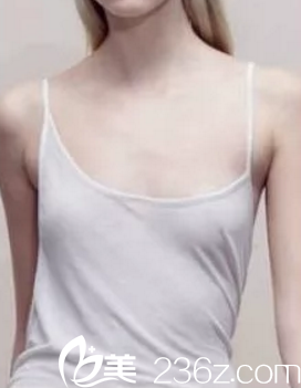 手術(shù)前的我 手術(shù)前的我