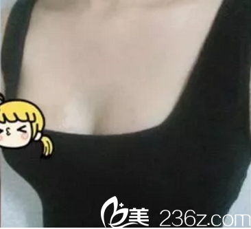 術(shù)后一周的效果