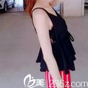 術(shù)前照片 術(shù)前照片