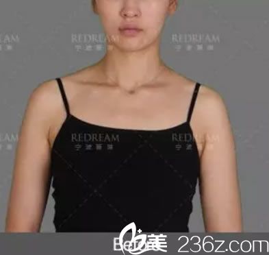 在寧波薇琳醫(yī)美做隆胸前 在寧波薇琳醫(yī)美做隆胸前