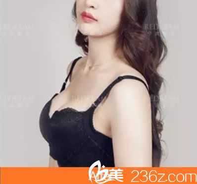 寧波薇琳娜綺麗假體隆胸<span style= 寧波薇琳娜綺麗假體隆胸<span style=