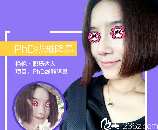 北京米蘭柏羽麗都于曉春隆鼻