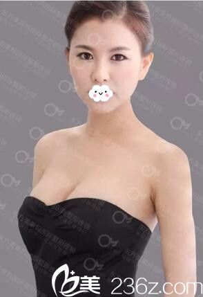 阜陽隆胸哪家好？阜陽東方美萊塢醫(yī)療美容醫(yī)院勇中華假體隆胸真人案例