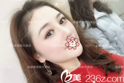 膨體隆鼻術(shù)后一個(gè)月恢復(fù)照片 膨體隆鼻術(shù)后一個(gè)月恢復(fù)照片