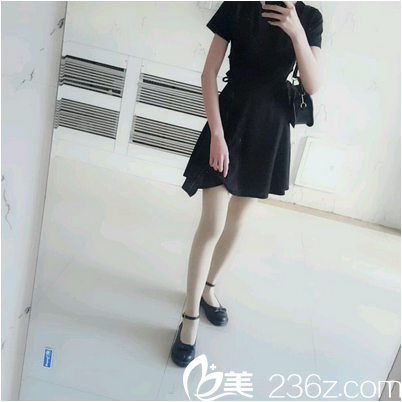 廣州美萊張毓吸脂怎么樣 廣州美萊張毓吸脂怎么樣