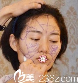 我術(shù)前時(shí)候 我術(shù)前時(shí)候