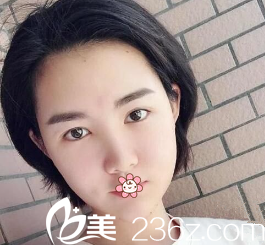 黃皓醫(yī)生給我做完手術(shù)第五天 黃皓醫(yī)生給我做完手術(shù)第五天