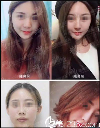 2018年贛州華美年終答謝會盛典特惠來襲，全線1折起，假體+耳軟骨鼻綜合特價優(yōu)惠，到院送脫毛/光子嫩膚/私密SPA任選