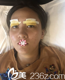 第二天我就變這樣了 第二天我就變這樣了