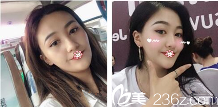 楊東運院長給我手術(shù)后第十天 楊東運院長給我手術(shù)后第十天